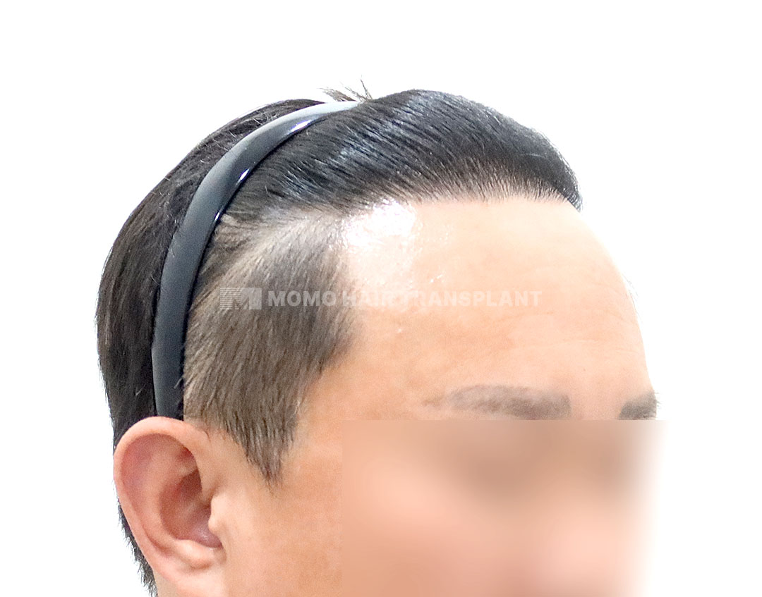 After