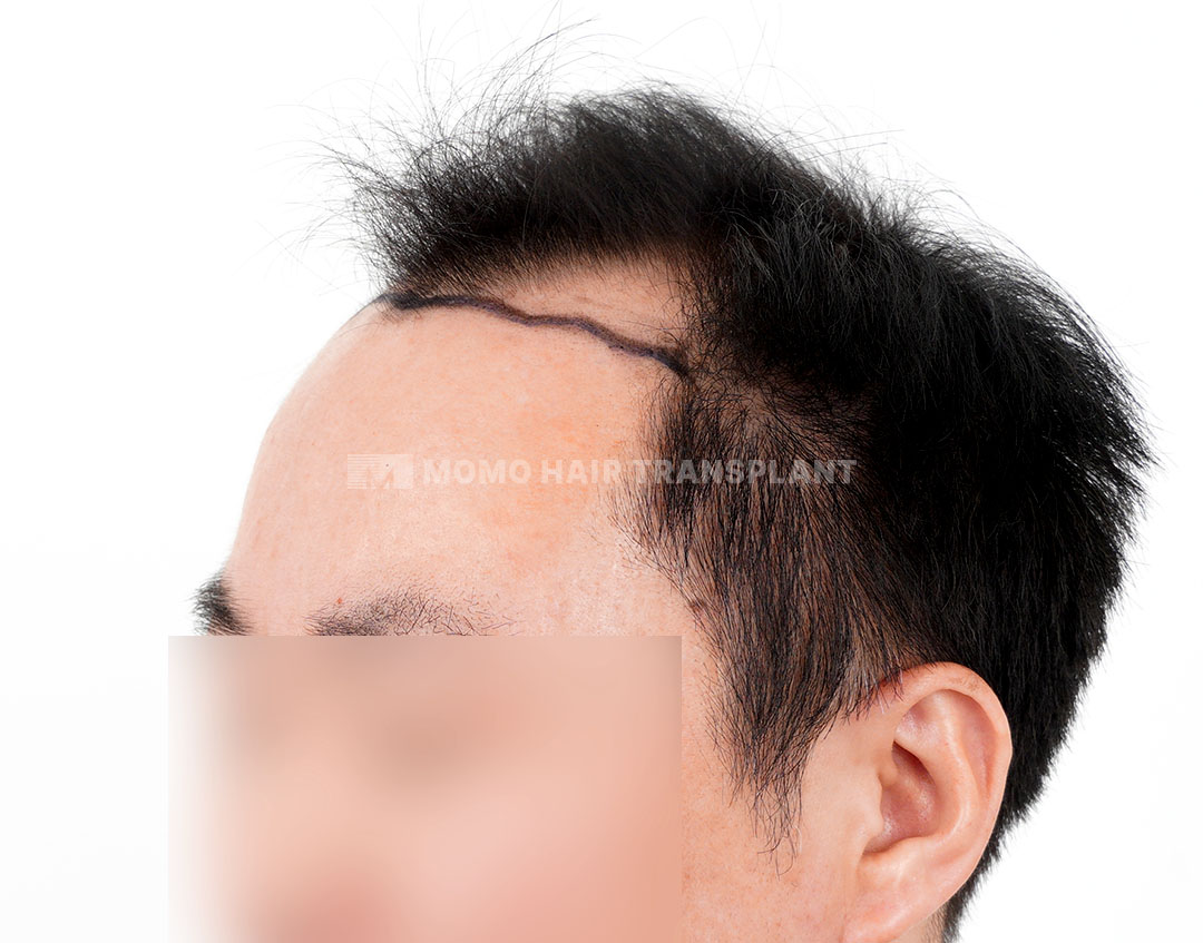 Before