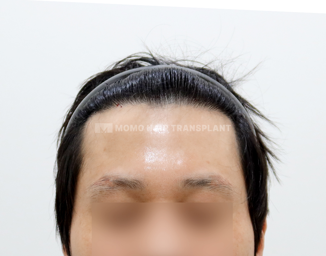 After