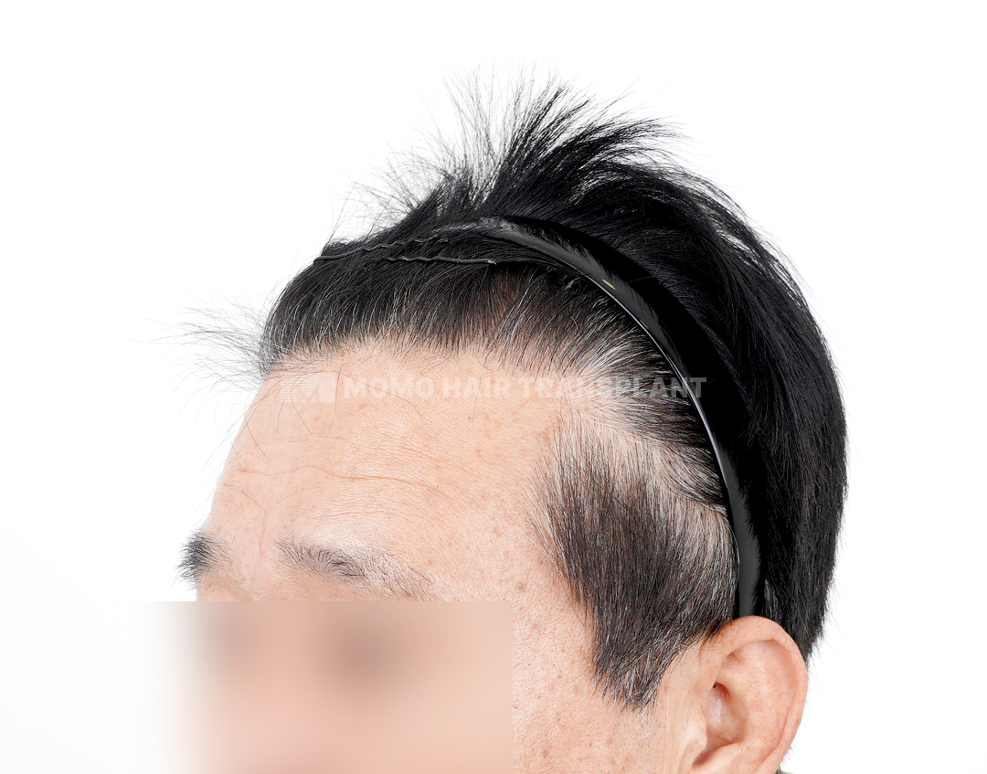 After