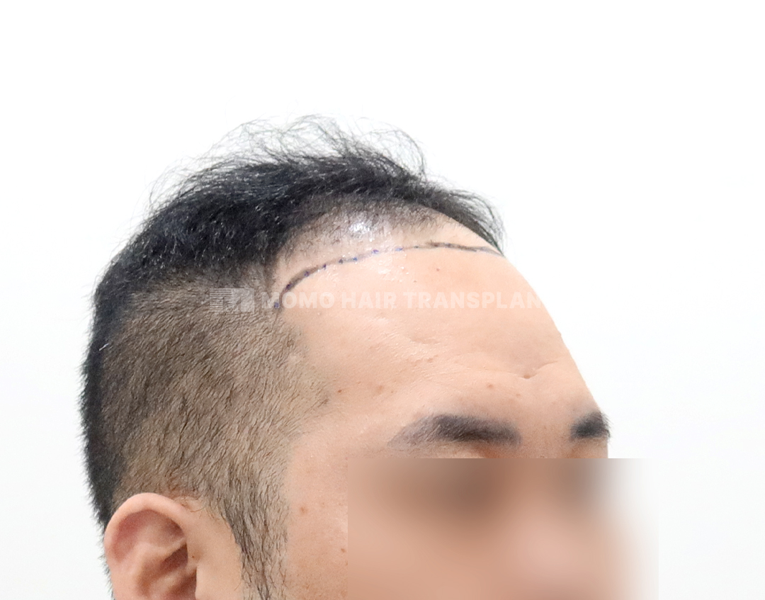 Before