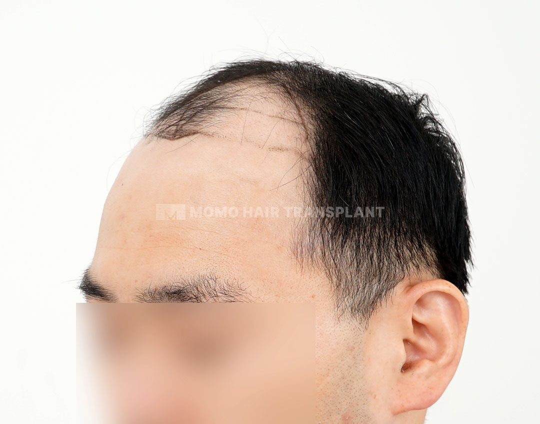 Before