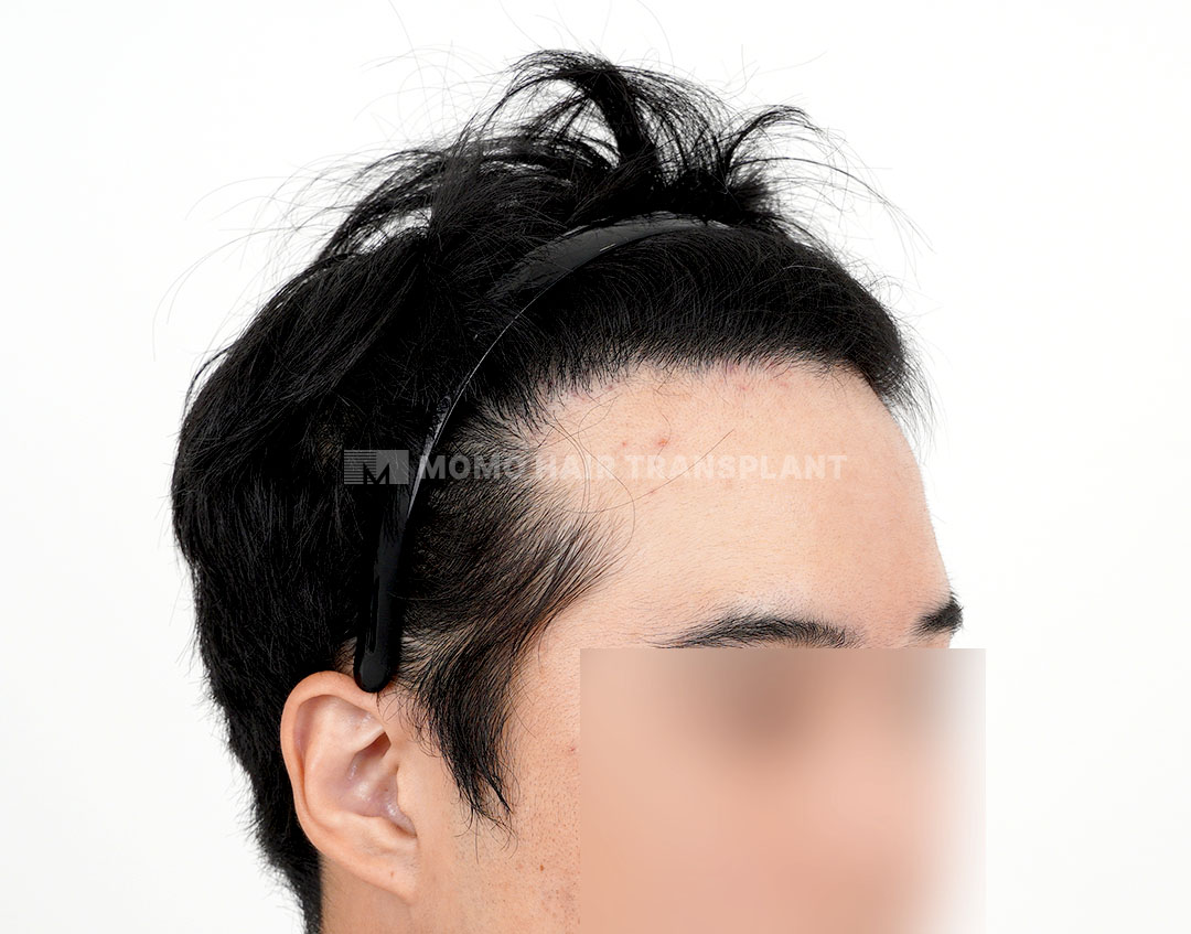 After