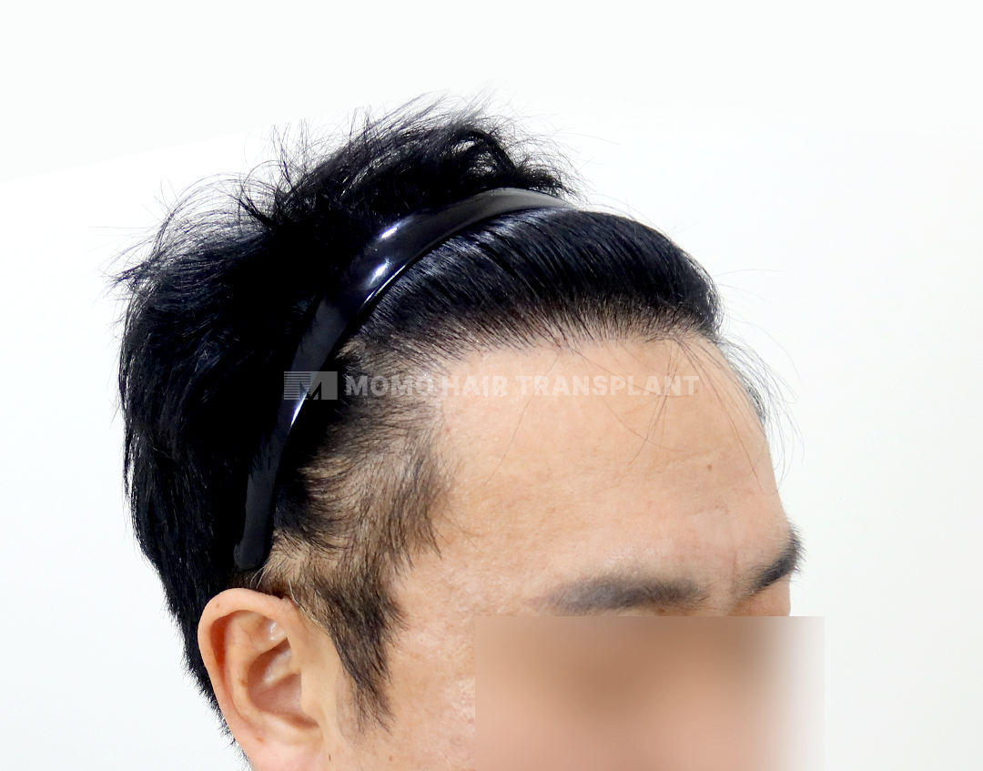 After
