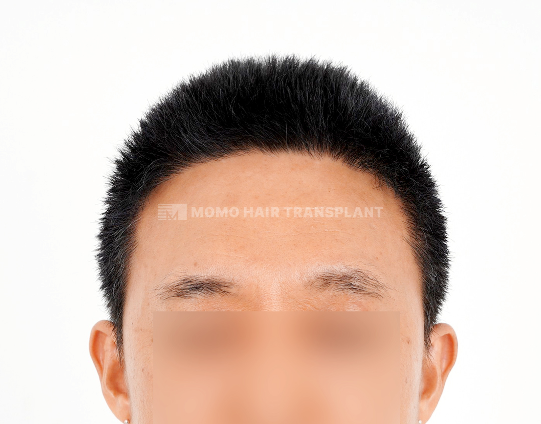 After