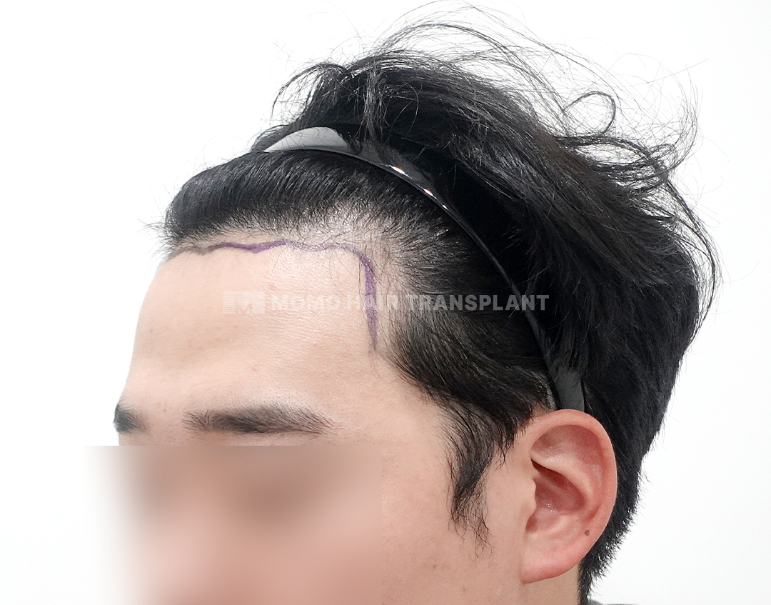Before
