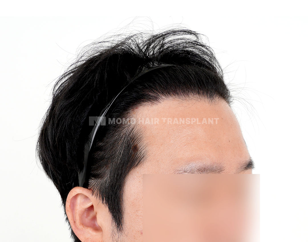 After