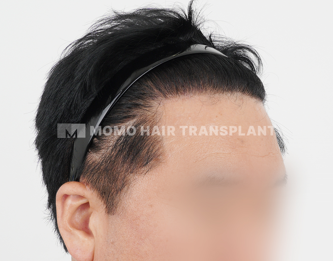 After