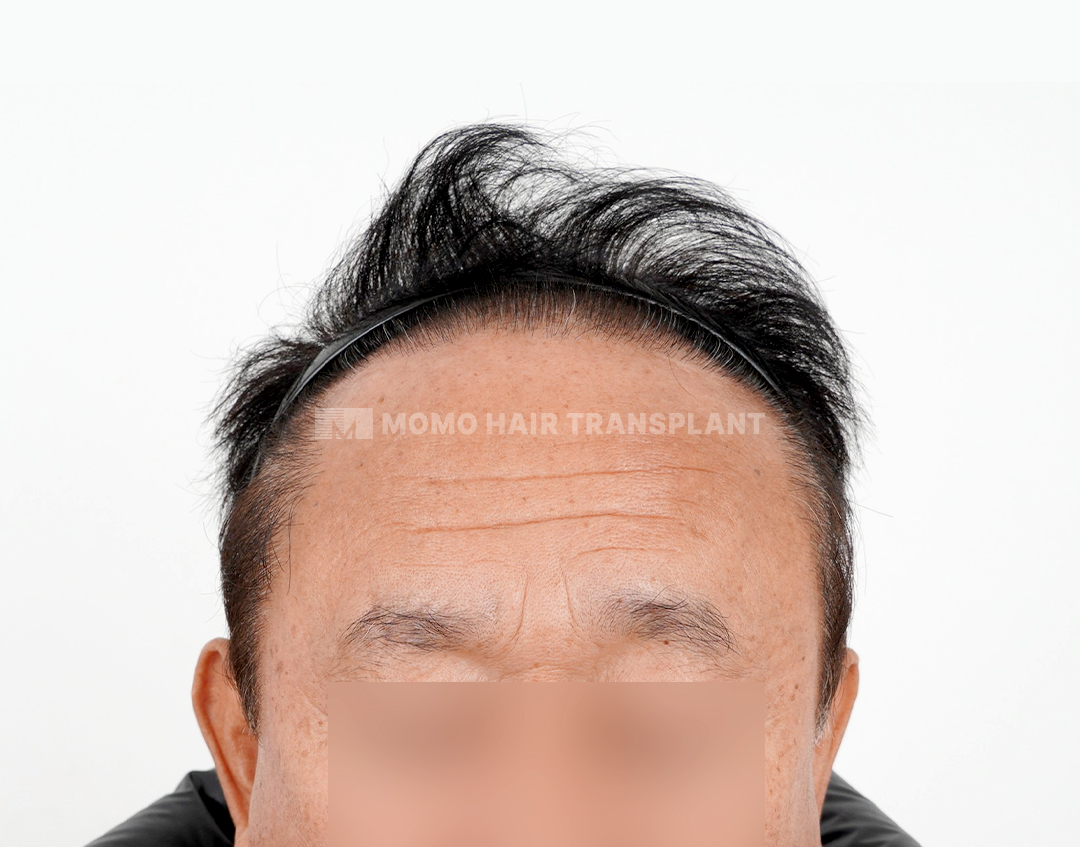 After
