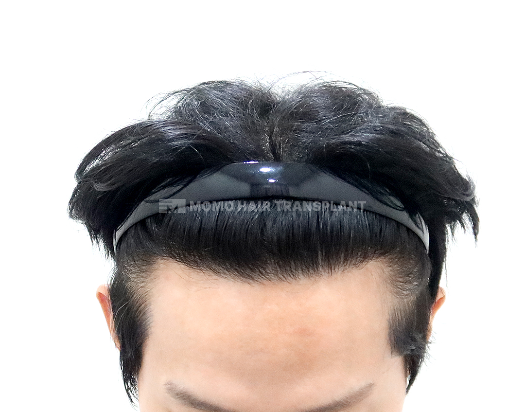 After