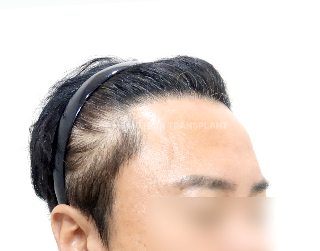 After