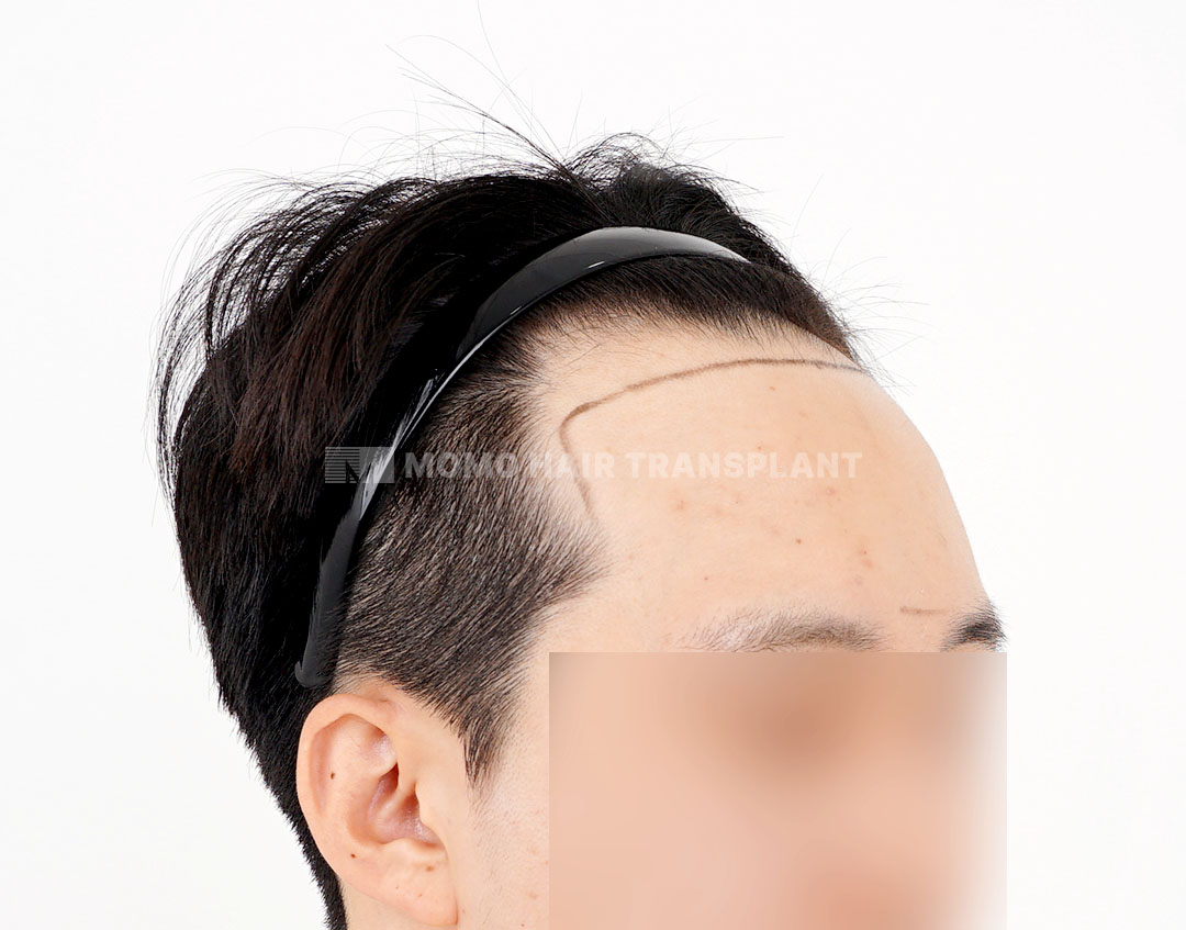 Before