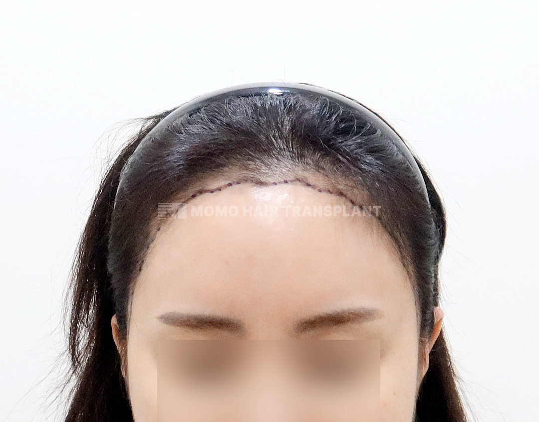 Before