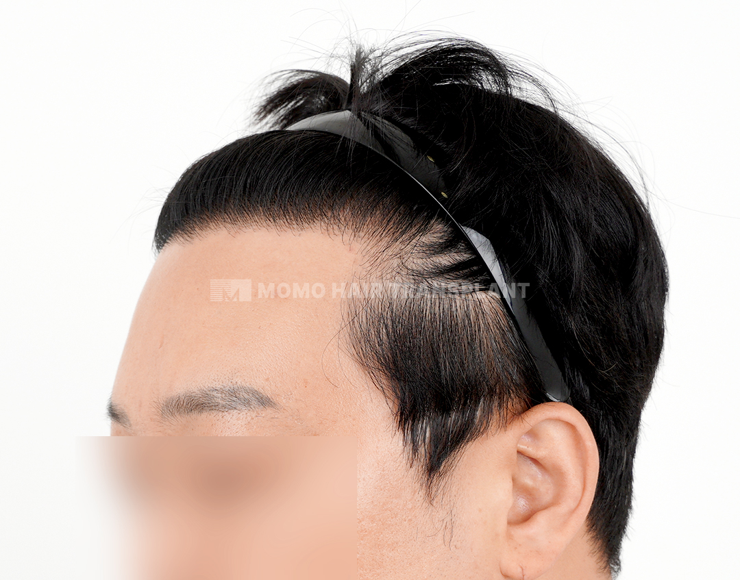 After