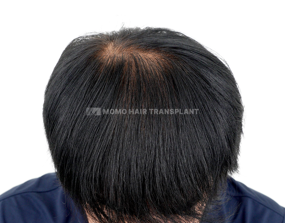 After