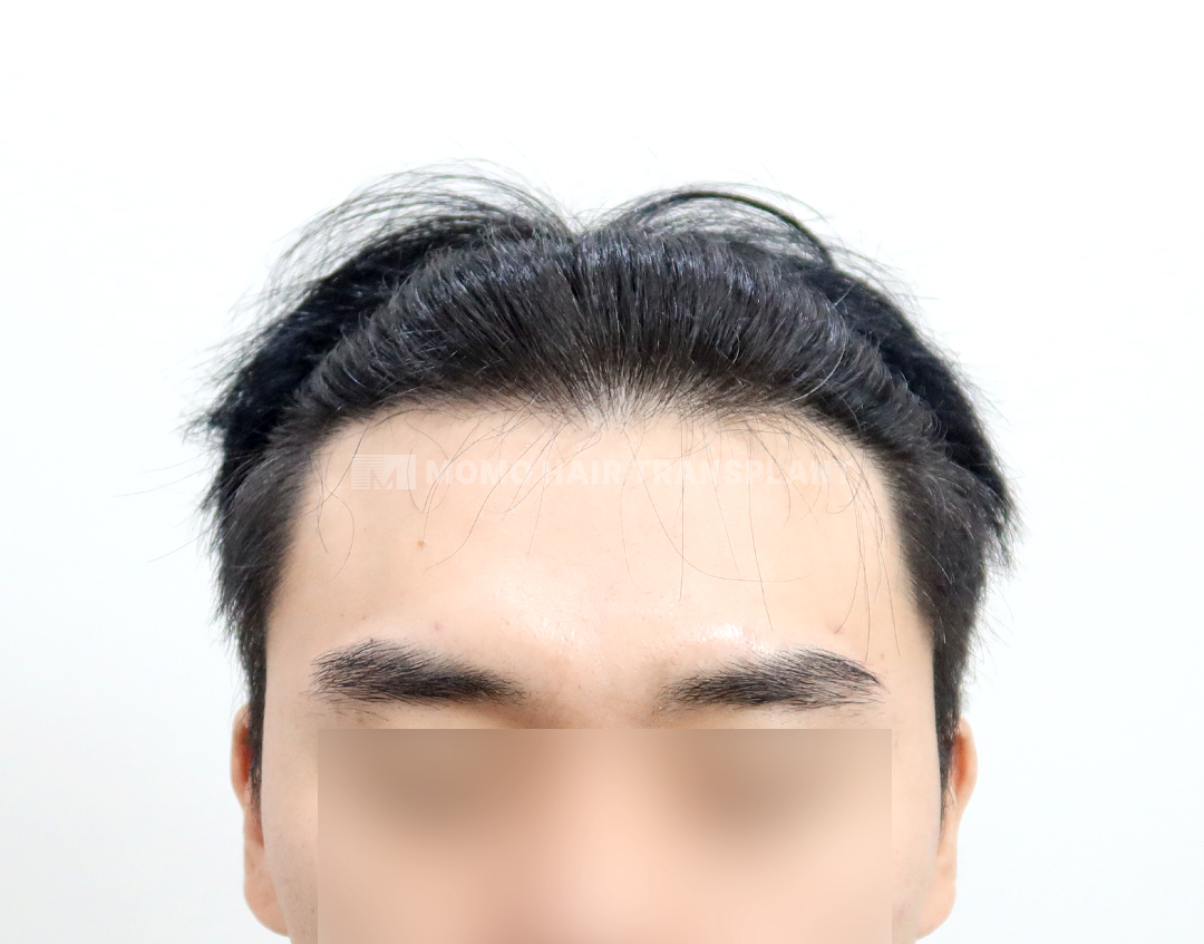 After
