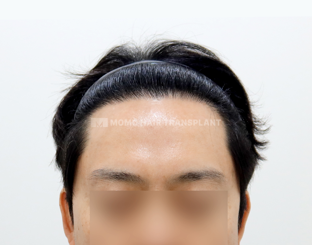 After