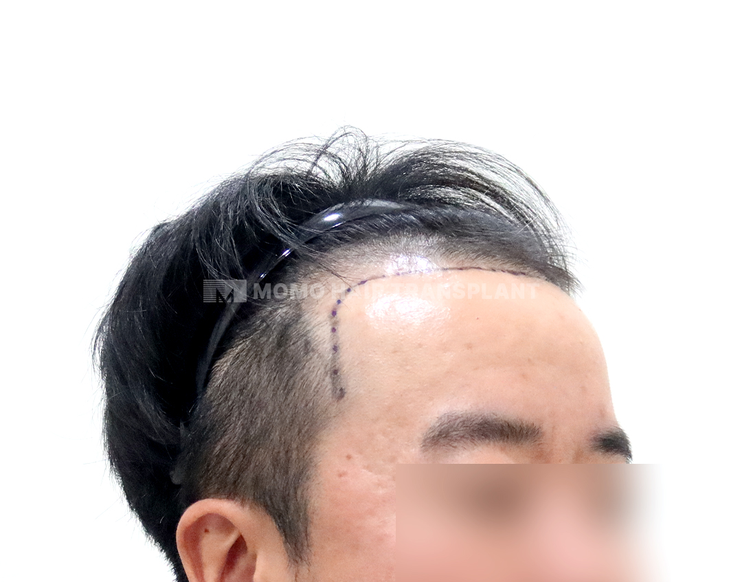 Before