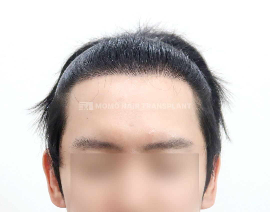 After