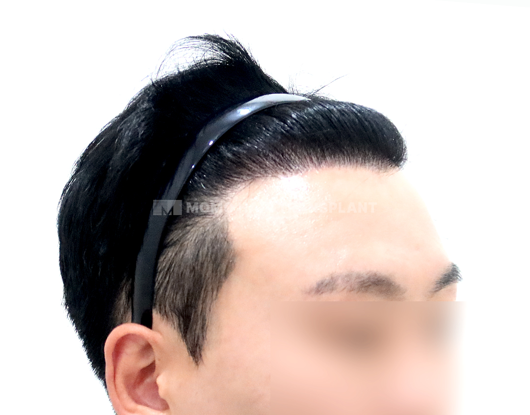 After