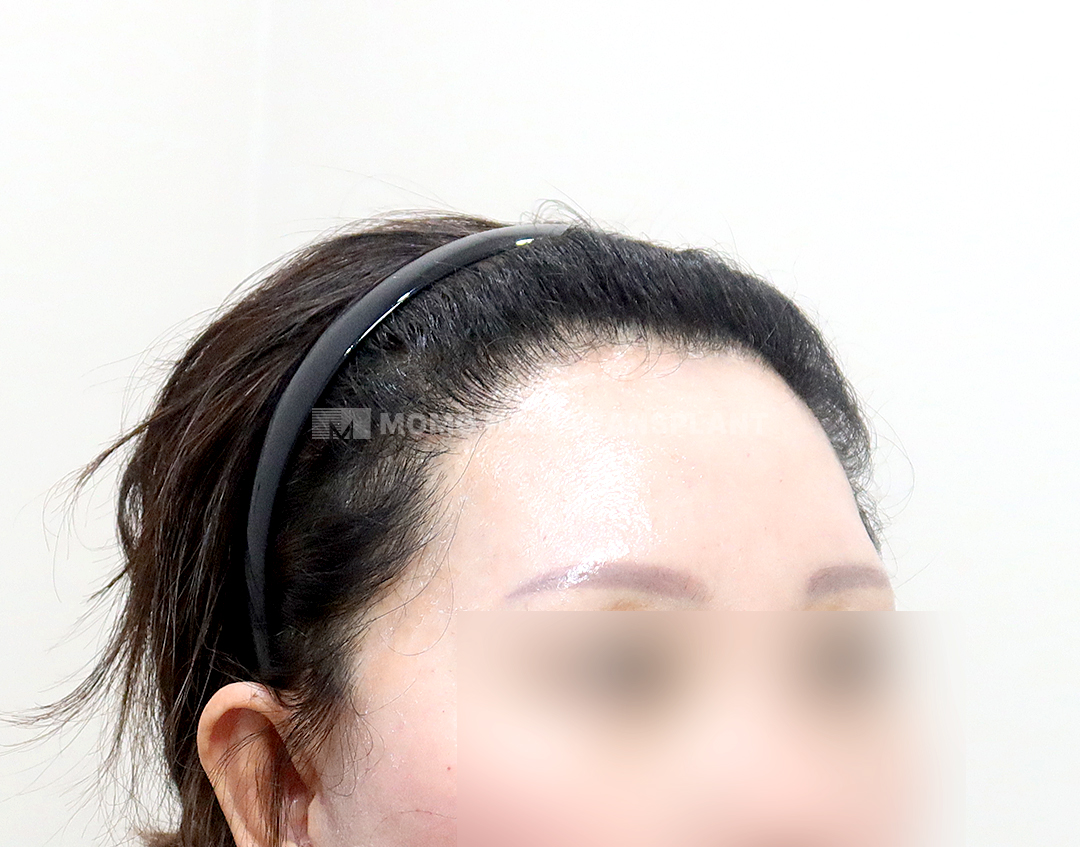 After