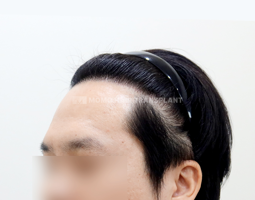 After