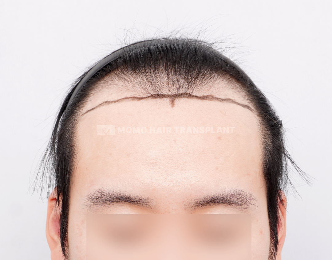 Before