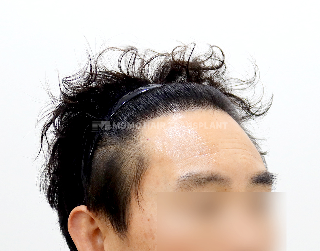 After